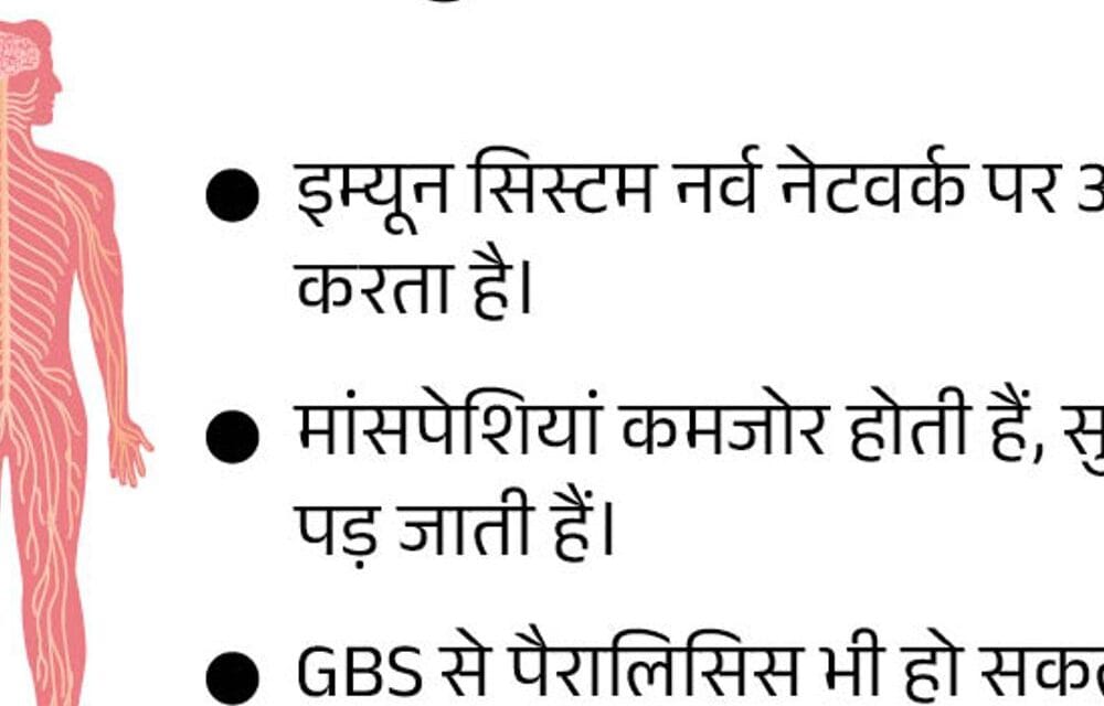 GB सिंड्रोम से महाराष्ट्र में अबतक 5 मौतें:असम में भी 17 साल की लड़की की मौत; पश्चिम बंगाल में 4 दिन में