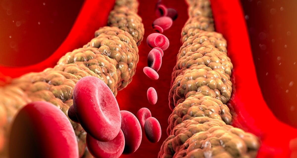 बैड कोलेस्ट्रॉल को करना है कंट्रोल, तो रोजाना 1 गिलास पी लें ये लाल रंग का जूस