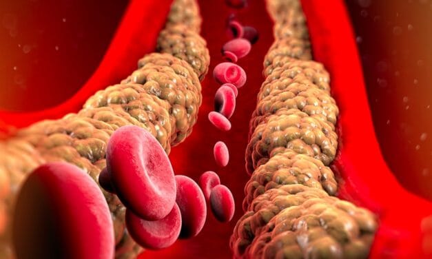 बैड कोलेस्ट्रॉल को करना है कंट्रोल, तो रोजाना 1 गिलास पी लें ये लाल रंग का जूस