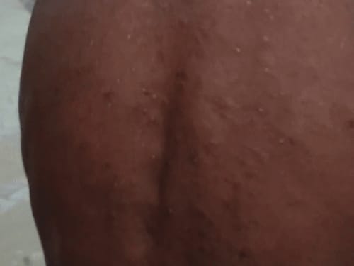 सिरसा घग्घर ड्रेन से शक्कर मंदौरी का हर घर संक्रमित:एलर्जी-बुखार की शिकायत, ग्रामीण बोले