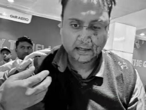 दिल्ली एयरपोर्ट पर पैसेंजर से मारपीट, पायलट सस्पेंड:यात्री का दावा