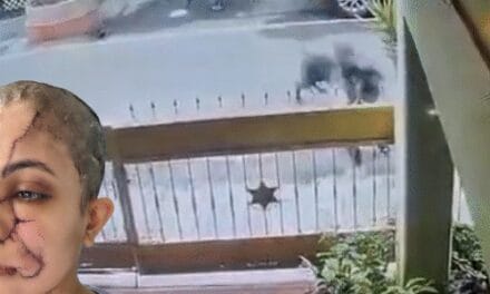 बेंगलुरु में पालतू कुत्ते का महिला पर हमला, VIDEO:चेहरे-गर्दन पर काटा, 50 से ज्यादा टांके आए; बचाने आए युवक पर भी झपटा