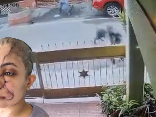 बेंगलुरु में पालतू कुत्ते का महिला पर हमला, VIDEO:चेहरे-गर्दन पर काटा, 50 से ज्यादा टांके आए; बचाने आए युवक पर भी झपटा