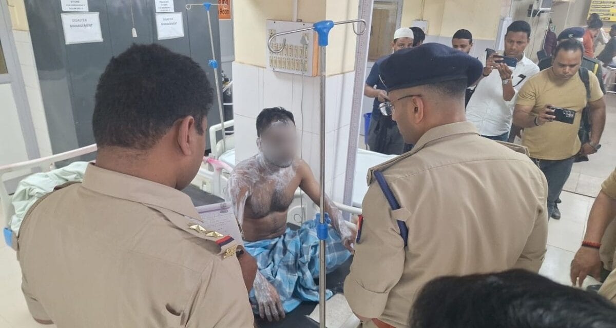 कानपुर: बीवी से अवैध संबंध के शक में रिश्तेदार को तेजाब से नहलाया