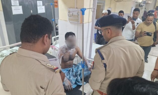 कानपुर: बीवी से अवैध संबंध के शक में रिश्तेदार को तेजाब से नहलाया