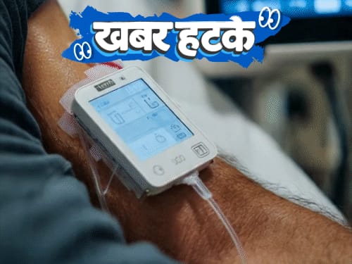 खबर हटके-बहन के काटने पर रेबीज इंजेक्शन लेने पहुंचा भाई:मौत से पहले डॉक्टर को अलर्ट करेगा AI-बेड; युवक ने रोने का बिजनेस शुरू किया