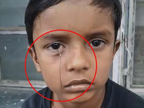 टॉय कार से निकला तार बच्चे की आंख में घुसा:घर में खेलते समय हादसा, पिता ने एक दिन पहले 250 रुपए में दिलाई थी