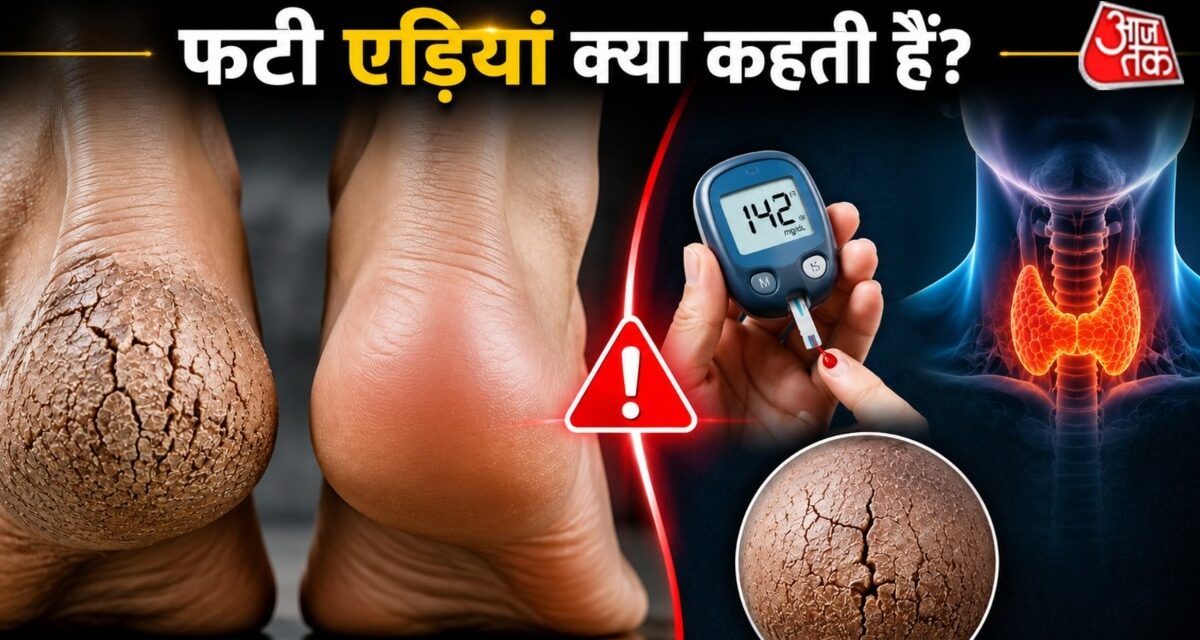 क्या आपकी एड़ियां बार-बार फटती हैं? इन छिपी बीमारियों का हो सकता है इशारा
