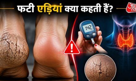 क्या आपकी एड़ियां बार-बार फटती हैं? इन छिपी बीमारियों का हो सकता है इशारा
