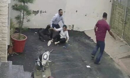 पटियाला में पिटबुल डॉग के अटैक का VIDEO:मकान देखने आए कपल पर झपटा; महिला की बाजू, जांघ, कूल्हा चबाया; पति की पीठ नोची
