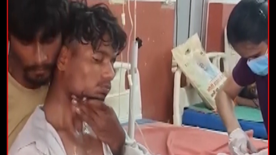 हरदोई में भाई ने 150 थप्पड़ मारकर बचाई भाई की जान!