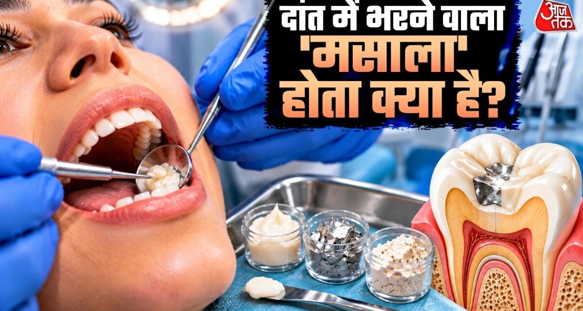 कांच, चांदी… दांत में जो मसाला भरते हैं डॉक्टर, वो क्या चीज होती है?