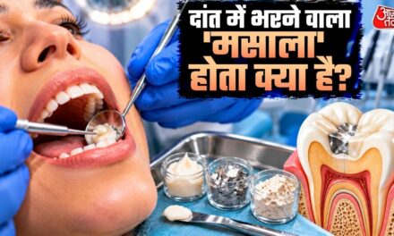 कांच, चांदी… दांत में जो मसाला भरते हैं डॉक्टर, वो क्या चीज होती है?